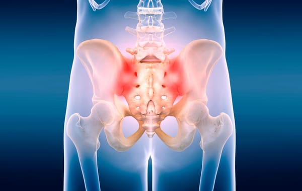 Sacroiliac Joint Pain - How Do I Help My Patients?